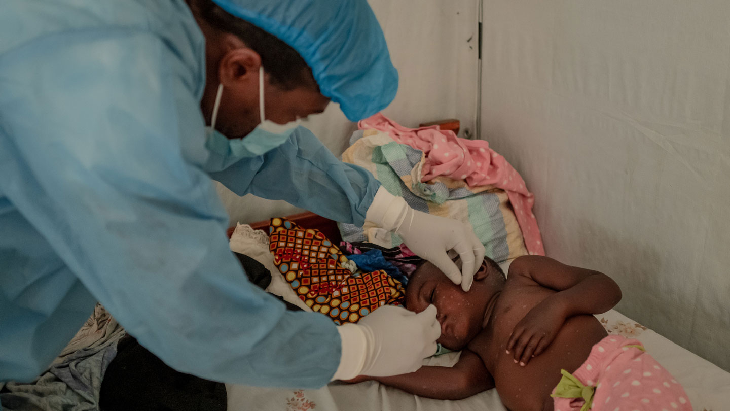 A health care worker wearing protective medical clothing examines a young boy at an mpox treatment center.